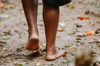 New WHO plan urges stronger action against fungal disease