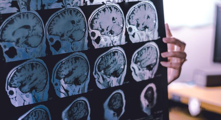 New guidance offers hope for reducing the global toll of dementia
